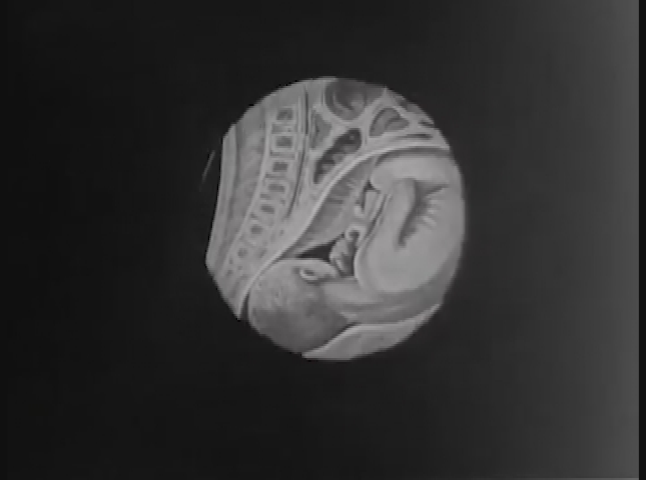 SHORTS "The Science of Life: Personal Hygiene for Young Women" (1920)